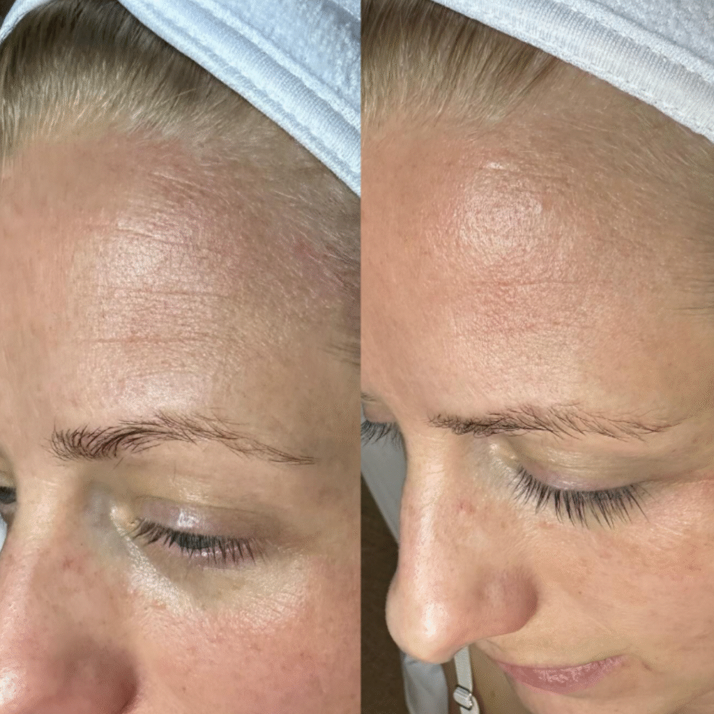 Optimized with keyphrase, describing the visible result (clarity, glow, texture, lines, radiance).