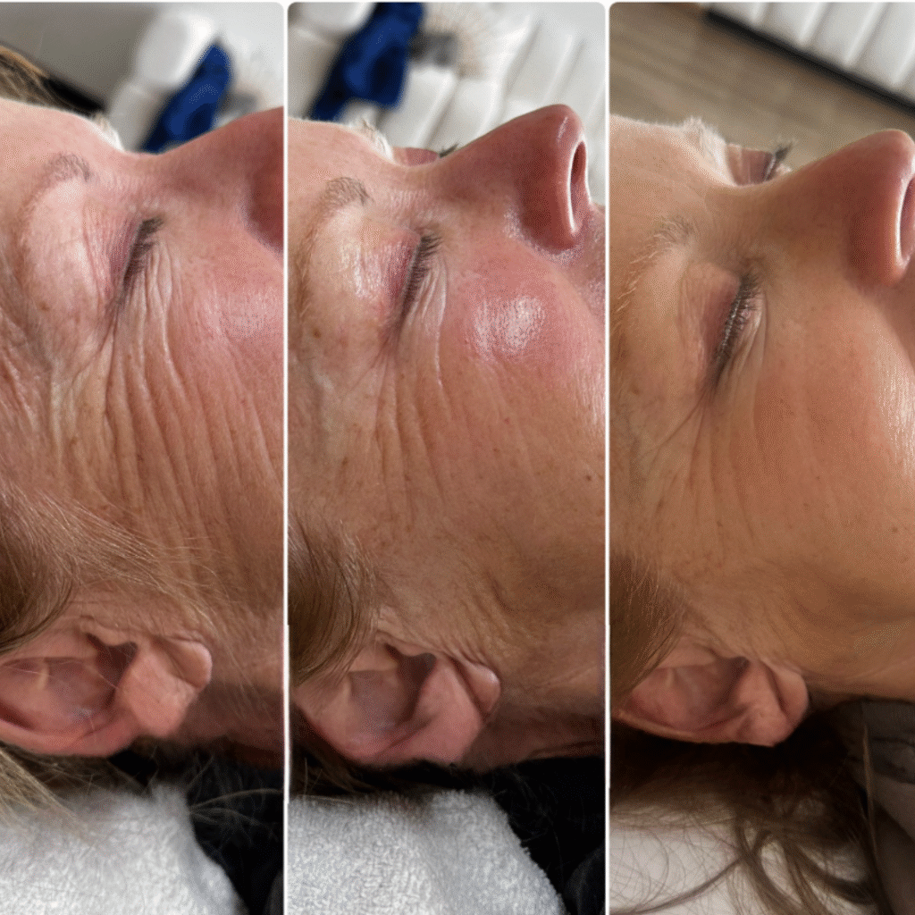 Optimized with keyphrase, describing the visible result (clarity, glow, texture, lines, radiance).